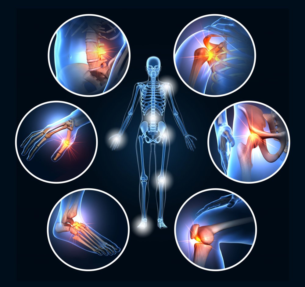 Arthritis & Joint Pain Management